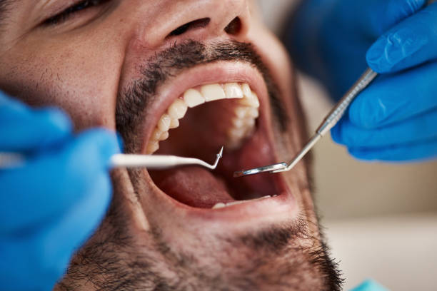 Best Knocked-Out Tooth Emergency  in Helemano, HI