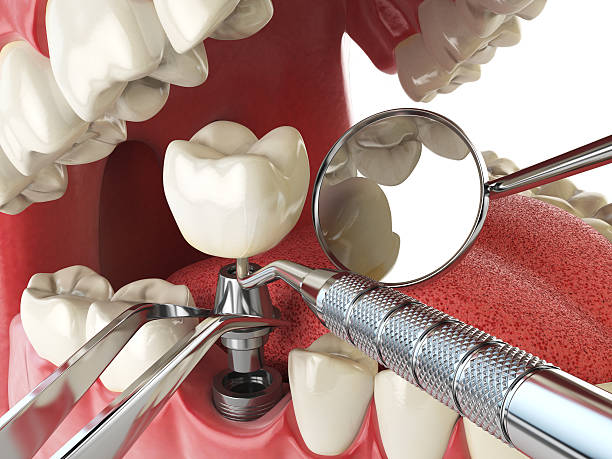 Best Broken Tooth Emergency  in Helemano, HI
